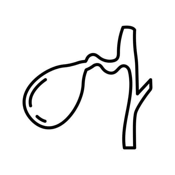 Cholecystitis